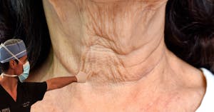 Un médico avisa: La causa principal de la flacidez no es la edad.