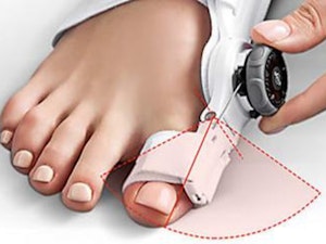 At long last, a bunion corrector that really works!