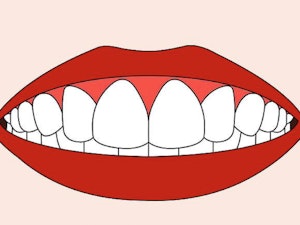 Obtenez des dents blanches à moindre coût