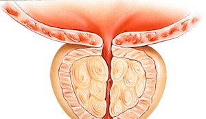 Vídeo Próstata: un experto español revela un simple truco para mejorarla Vídeo Próstata: un experto español revela un simple truco para mejorarla